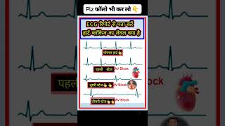 ECG Report stage ecg education gk [upl. by Trella]