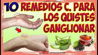 10 Remedios Caseros para Quistes Ganglionar  Como Aliviar Quistes Ganglio [upl. by Lorelle457]