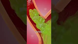 How acid reflux happens 🥵 Acidity and gas problem  GERD shorts viralvideo  creativelearning3d [upl. by Kerns]