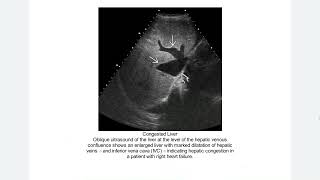 ABDOMEN PELVIS EXPERT DDX [upl. by Mcspadden107]