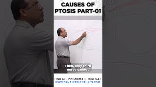 Causes Of Ptosis Part 01 drnajeeblectures drnajeeb shortvideo [upl. by Elleivap]