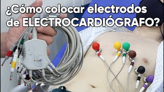 ¿Cómo colocar los electrodos de un electrocardiógrafo [upl. by Newman354]