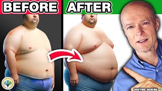 Top 10 LIES About Belly Fat People Still Believe [upl. by Yak]