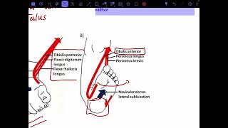 Talipes calcaneovalgus [upl. by Tutankhamen]