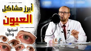 افرازات العين وعلاجها [upl. by Novi]