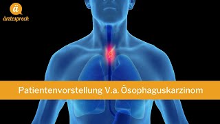 FSP Patientenvorstellung Ösophaguskarzinom [upl. by Mij]