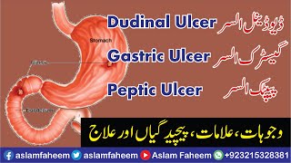 Peptic Ulcer Symptoms Causes and Treatment Urdu Hindi  Gastric Ulcer and Dudinal Ulcer Difference [upl. by Weibel]