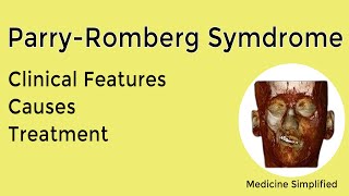 Parry Romberg Syndrome  Causes Symptoms Treatment and Clinical Features [upl. by Addy]