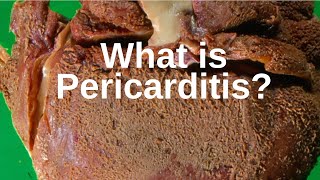 What is Pericarditis  Pathology mini tutorial [upl. by Adnahcal767]