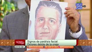 Prevención de la parálisis facial [upl. by Valdis]