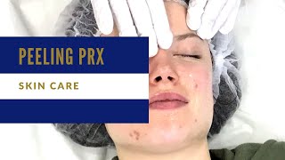 Peeling PRXT33 avec Claire [upl. by Yanehc]