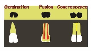 Fusion Gemination amp Concrescence [upl. by Ecinuahs18]