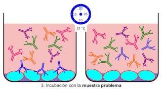 Video ELISA INDIRECTA [upl. by Corson]