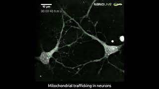 Visualizing mitochondrial trafficking in neurons [upl. by Edette]