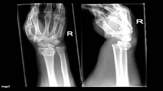 Approach to Orthopaedic Xrays [upl. by Oijile]