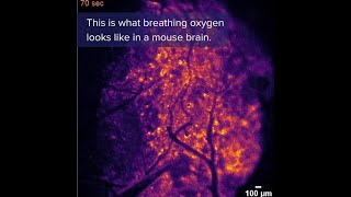 NEW research uses a protein related to a fireflys glow to see oxygen in the brain science [upl. by Avery]