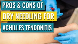 Dry Needling For Achilles Tendinopathy  Tendonitis — Does It Help [upl. by Clothilde]