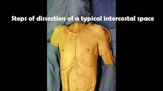 Steps of dissection of a typical intercostal space [upl. by Ajiak450]