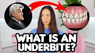 Underbite Correction EXPLAINED causes amp treatments [upl. by Benkley739]