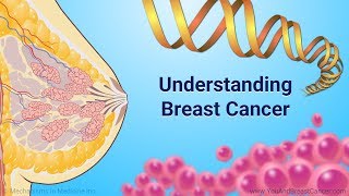 Understanding Breast Cancer [upl. by Nehtan]