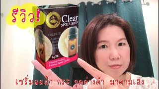 รีวิว เซรั่ม แต้มฝ้า มาดามเฮง ลดฝ้า กระ จุดด่างดำ Clear spots sol Madame heng [upl. by Allez446]