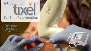 Introducing The Brand New Tixel For Skin Rejuvenation  Steven F Weiner MD [upl. by Skutchan]