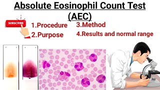 Absolute Eosinophils count ll AEC count Eosinophilia  Eosinopenia [upl. by Osmund]