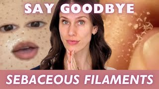 How To Get Rid Of Sebaceous Filaments [upl. by Winther]