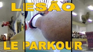 SKATE LESÃO SEM NOÇÃO E LE PARKOUR [upl. by Can499]