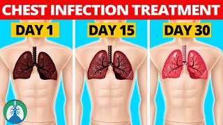 7 Natural Chest Infection Treatments Home Remedies [upl. by Merideth]