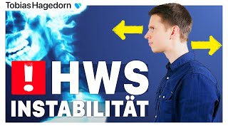 Halswirbelsäule HWS INSTABILITÄT 🤯  Unterschätzte Ursache für Schmerz Schwindel amp Tinnitus [upl. by Sand911]