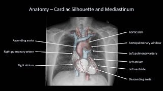 How to Interpret a Chest XRay Lesson 2  A Systematic Method and Anatomy [upl. by Noiro]