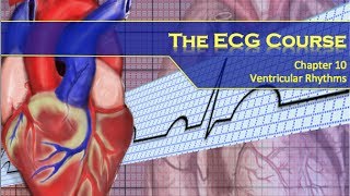 The ECG Course  Ventricular Rhythms [upl. by Law134]