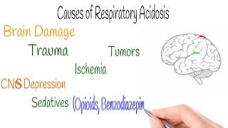 Respiratory Acidosis amp Alkalosis ABG Part 3 [upl. by Alvina]