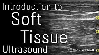 Introduction to Soft Tissue Ultrasound [upl. by Homans]