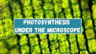 Photosynthesis under the microscope [upl. by Vinni]