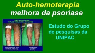 ESTUDO DE CASO DO GRUPO DE PESQUISAS SOBRE AUTOHEMOTERAPIA  UNIPAC [upl. by Reba]