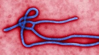 Ebola defense options Quarantine isolation and selfmonitoring [upl. by Nnylyar27]