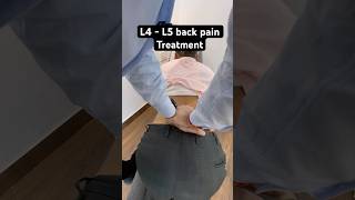 L4  L5 back pain treatment by dr harish grover [upl. by Drusilla]