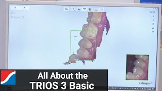 3Shape TRIOS 3 Basic Features and Benefits [upl. by Ennaeirb]