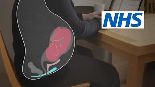 How and when should I do pelvic floor exercises  NHS [upl. by Llert]