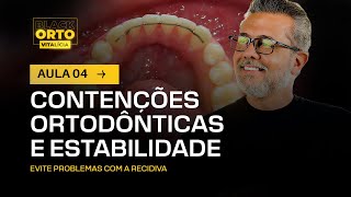 Aula 49  Contenções ortodônticas e estabilidade [upl. by Anekahs]