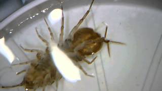 microscope video of asellus aquaticus waterlouse aquatic sowbug  Wasserassel unterm Mikroskop [upl. by Llyrat]