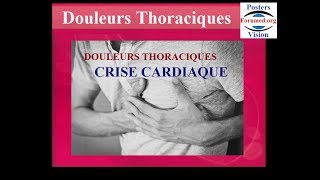 Reconnaitre une crise cardiaque des autres douleurs thoraciques symptomes [upl. by Aynatal]