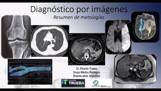 METODOS DE DIAGNOSTICO POR IMAGENES [upl. by Pius]