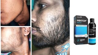 mintop minoxidil 5 beard  minoxidil beard growth  how to grow beard derma roller for beard growth [upl. by Carrel384]