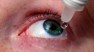 علاج جفاف العين  Dry eye treatment [upl. by Eustace]