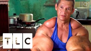 Bodybuilders Inject Muscles With Oil  Real Life Hulks [upl. by Caitrin249]