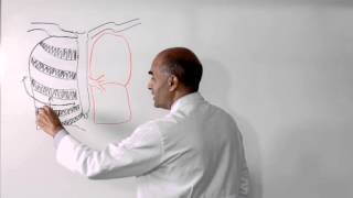 Lobectomy of Lung  How is it Performed [upl. by Annua]