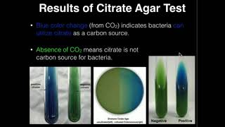 Microbiology Citrate Agar [upl. by Akeemaj]